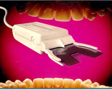 Occlusal Analysis