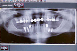 Digital Radiography