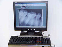 Digital Radiography
